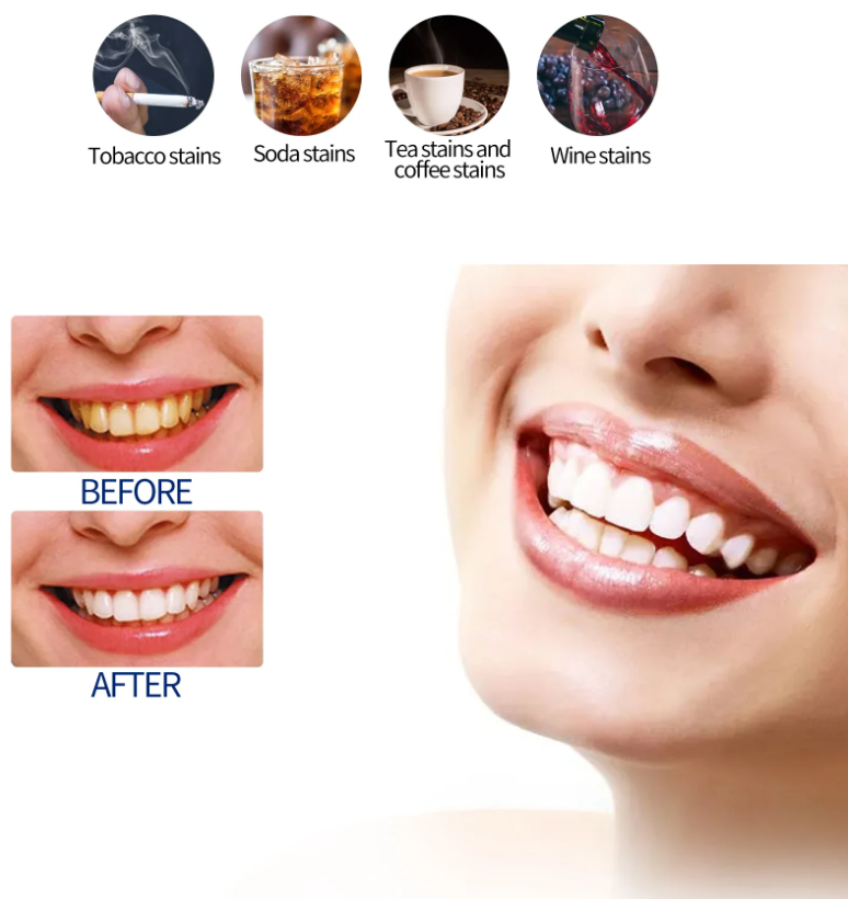 Heviver Teeth Whitening Kit New Smart 16 LED Teeth Beauty Instrument Dental Bright White 4 Gel Set Teeth Bleaching Oral Care